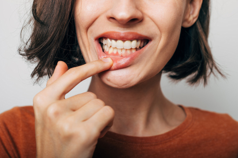 Patient smiling after cosmetic dentistry